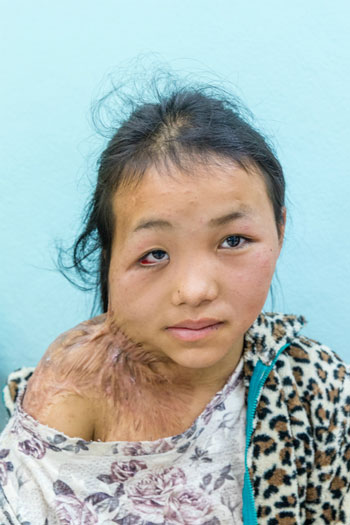 Photo of Houphan before surgery