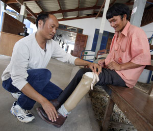 Man being fitted with prosthetic leg