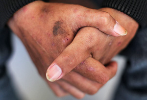 Photo of two mens hands clasped together